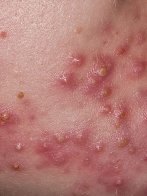 getImage-2020-02-15T160341.601